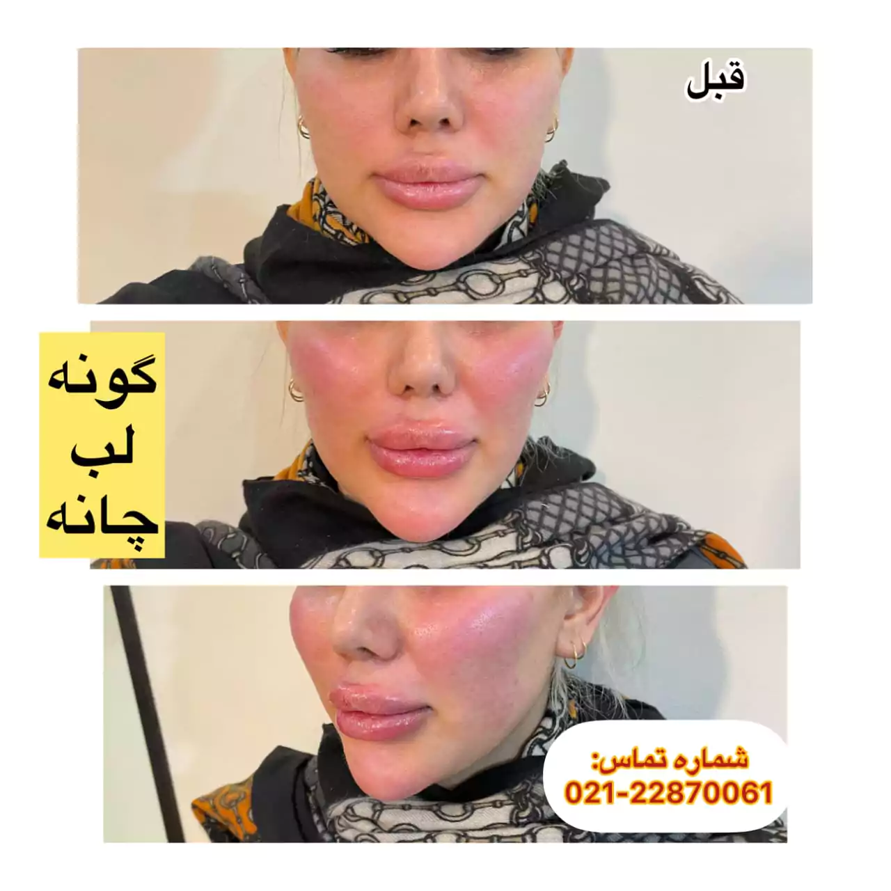 بهترین کلینیک پوست و مو زیبایی در ظفر